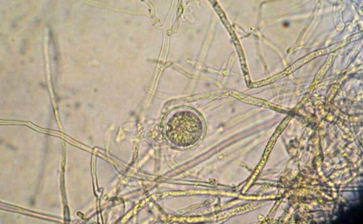 oospore-phytophthora-infestans-1200.jpg